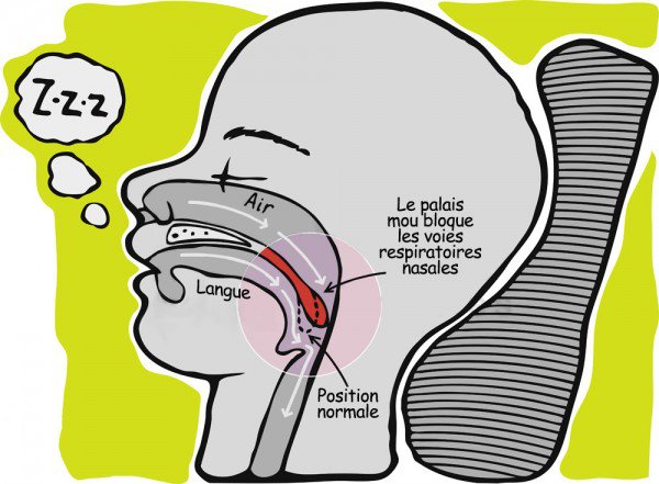 Comment arrêter de ronfler avec des remèdes naturels !