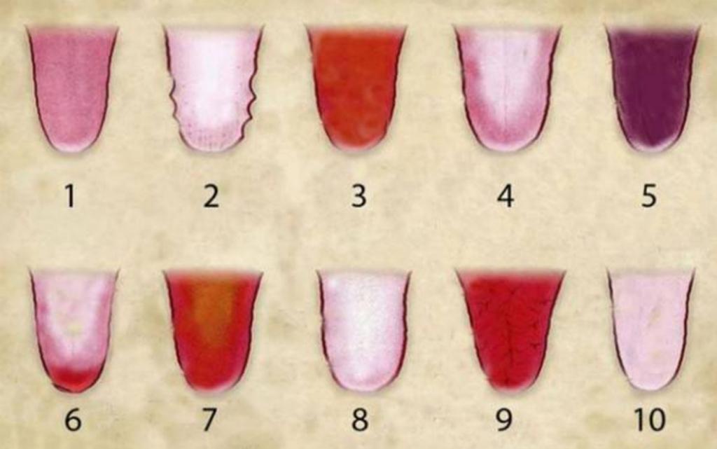 Voici ce que la couleur de votre langue révèle sur votre état de santé