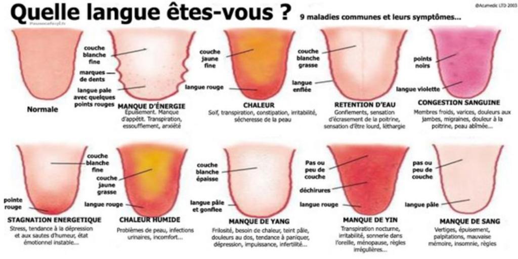 Voici ce que la couleur de votre langue révèle sur votre état de santé