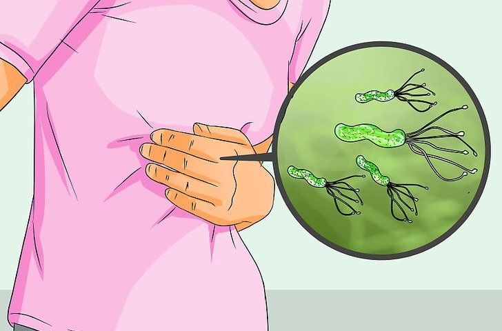 Helicobacter pylori