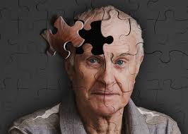 conséquences d'Alzheimer