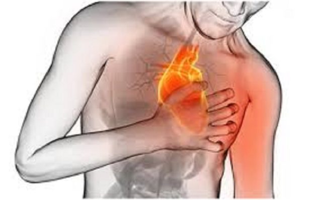 Infarctus Du Myocarde