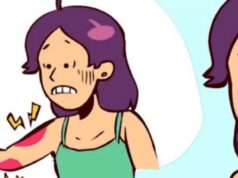 lupus