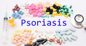 traitements du psoriasis