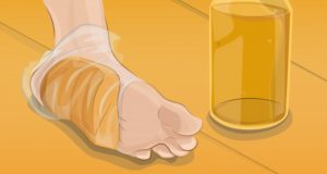 Garder vos pieds en bonne santé