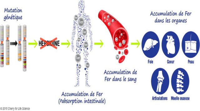 hémochromatose